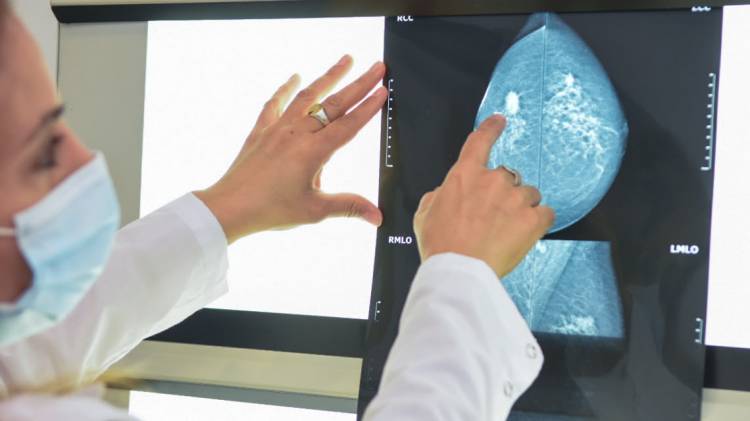 La Agencia de Cáncer entregará turnos para mamografía en plazas de Santa Fe, Rosario y Rafaela