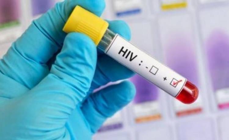 El Concejo pide información sobre la provisión de insumos para HIV y preservativos